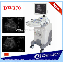 equipo de ultrasonido para embarazo y ecografía DW370